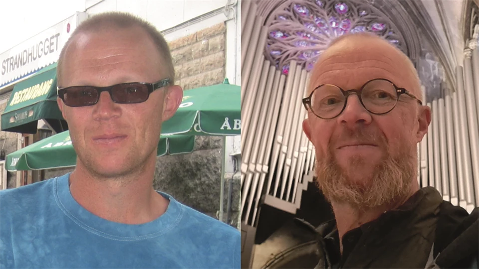 Två porträttbilder på en man, den vänstra visar honom för 20 år sedan och den högra visar honom idag.