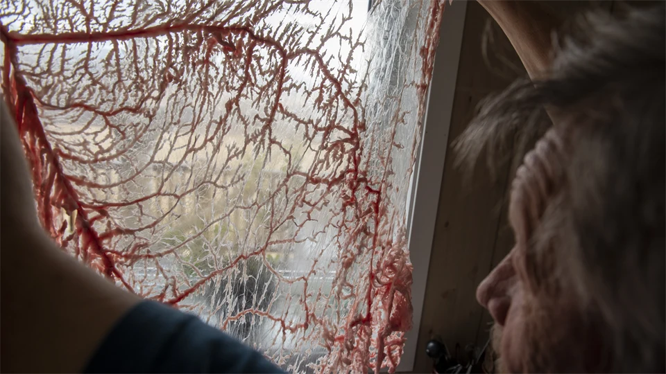 En man håller upp en fetthinna.